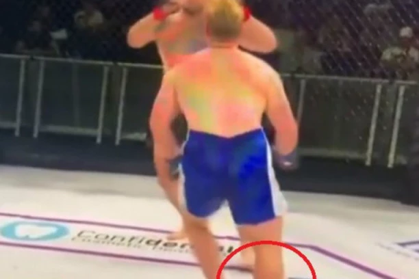 (VIDEO) NAJSUROVIJI MMA SNIMAK OD KOG VAM NEĆE BITI DOBRO! Pukla noga kao da je PRUT, borac ostao bez obe potkolenične kosti!