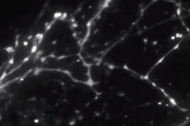 HOROR OTKRIĆE NAUČNIKA: U mozgu preminulih otkrivene "ZOMBI ĆELIJE"