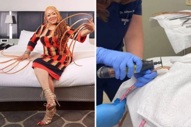 Žena sa najdužim noktima na svetu konačno ih je odsekla