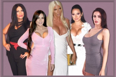 (FOTO) Ovo su javne ličnosti za koje se priča da su imale BIZARNU OPERACIJU!