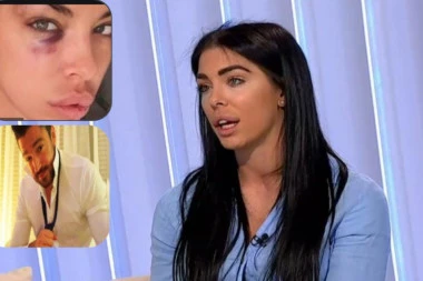 IMALA SAM TEŠKE POVREDE, JOŠ ČEKAM PRAVU! Ana Marija progovorila o nasilju koje je pretrpela od Vlade Stanojevića!