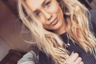 OSETILA SAM DA MI LICE GORI: Izašla u kafić da proslavi rođendan, a onda je grejalica EKSPLODIRALA i unakazila je!