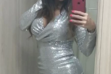 (FOTO) LAŽNI HIRURG JOJ UNAKAZIO LICE! Zvezda Granda prošla kroz agoniju zbog estetske intervencije!