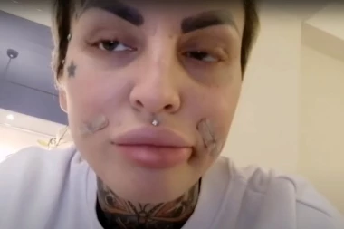 ŽENO, ŠTA TI SE DESILO SA LICEM? Jelena Krunić pre deset godina nije imala PLASTIKU, nazivaju je HODAJUĆOM NAKAZOM! (FOTO)