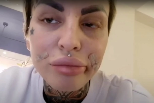 ŽENO, ŠTA TI SE DESILO SA LICEM? Jelena Krunić pre deset godina nije imala PLASTIKU, nazivaju je HODAJUĆOM NAKAZOM! (FOTO)