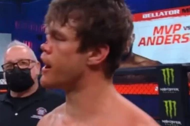 (VIDEO) NOS KAO PIHTIJA: Stravičan NOKAUT PRAVO U GLAVU, poseta PLASTIČARU rezervisana!