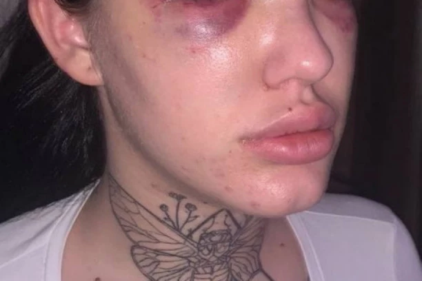 (VIDEO) PRETUČENA DRUGARICA TIJANE AJFON! Saru je dečko vukao po betonu i udarao GLAVU o ASFALT! Tijana: Gde mi živimo?