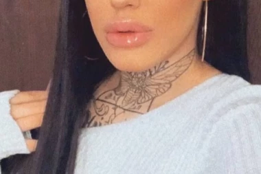 ZADOBILA HEMATOME, PROCURIO LEKARSKI I POLICIJSKI IZVEŠTAJ JEZIVO PRETUČENE drugarice  Tijane Ajfon!