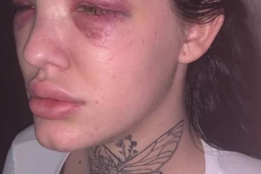 (FOTO) OTKRIVEN IDENTITET NAPADAČA: Evo ko je pretukao najbolju drugaricu Tijane Ajfon!