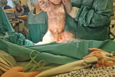 (FOTO) ZAMIŠLJALA DA ĆE RODITI MALOG, SLATKOG DEČAKA, ALI KAD GA JE VIDELA, SAMO JE JAUKNULA! Ova beba je završila na svim naslovnim stranama!