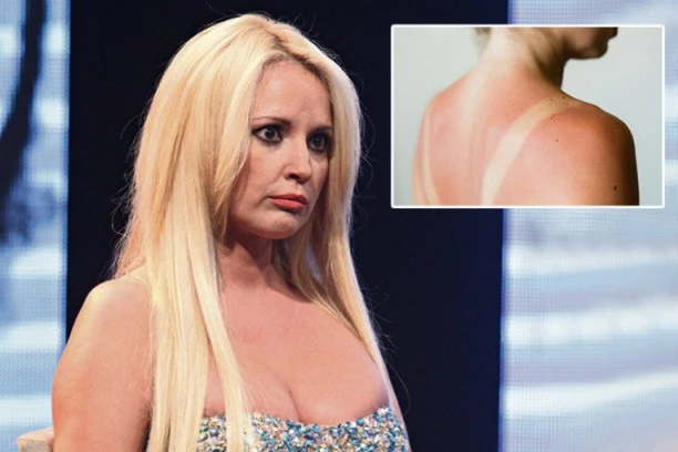 MAJA NIKOLIĆ SPALILA LEĐA KOLEGINICI: Mazala joj KONJSKU MAST PA JOJ NAPRAVILA OPEKOTINE!