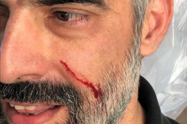 (FOTO) TUČA ADVOKATA U KAFIĆU: Cvejić nakon sednice fizički nasrnuo na Kokanovića