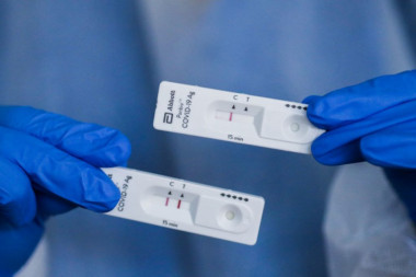 POUZDAN KAO I PCR: Antigenski test niške Neomedike uskoro u privatnim laboratorijama!