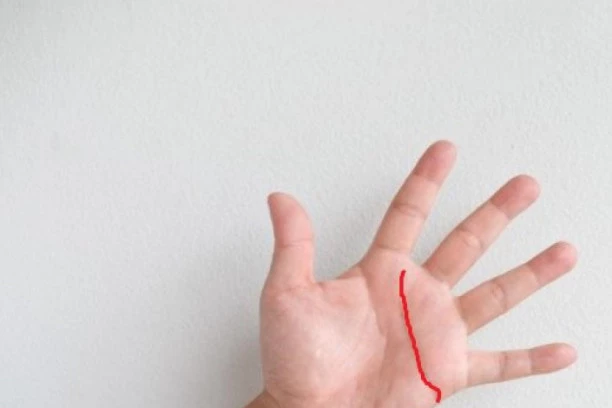 ŠTA DLAN OTKRIVA O ZDRAVLJU: Evo kako da ga pročitate!