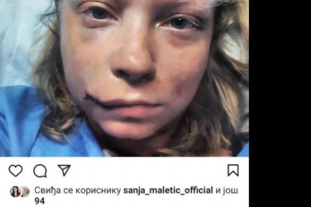 "KOSTI GLAVE SU MI BILE SMRSKANE": Glumica iz "Zone Zamfirove" doživela strašnu NESREĆU, njena objava i dalje LEDI KRV U ŽILAMA!