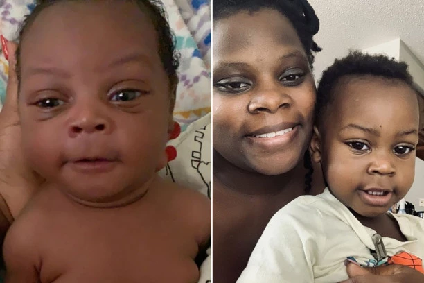 NIKADA RANIJE TO NISAM VIDELA: Majka rodila zdravog sina, ali par dana kasnije počele su da mu RASTU GRUDI, a pravi ŠOK je tek USLEDIO! (FOTO)