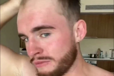 OTKRIO KAKO PRIKRIVA ĆELAVOST, NEĆETE VEROVATI OČIMA: Ili ćete voleti ovaj trik ili ćete se zgroziti! (VIDEO)