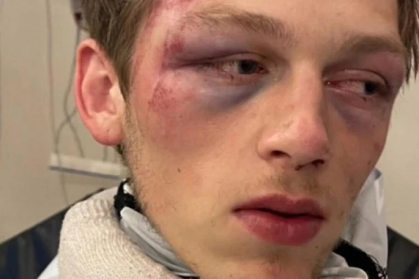 FOTOGRAF BRUTALNO PRETUČEN ZBOG CIGARETE I 200 DINARA: Lekari ne znaju kako da mu pomognu (VIDEO)