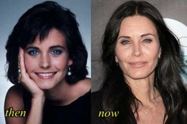 Evo šta radi MONIKA IZ "PRIJATELJA" umesto odlaska na estetske operacije ! (VIDEO)