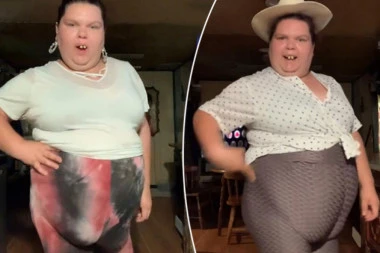 GOVORE JOJ DA IMA PREDNJU ZADNJICU: Ovoj ženi se mnogi rugaju, ali nju to ne pogađa - tvrdi da voli svoje telo! (VIDEO)
