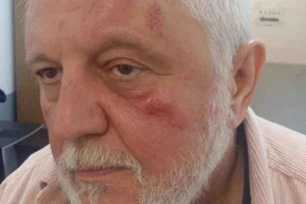 ANTONIJEVIĆ POTVRDIO DA GA JE BJELA TUKAO: Napao me s LEĐA, bio sam mu BOKSERSKA VREĆA!
