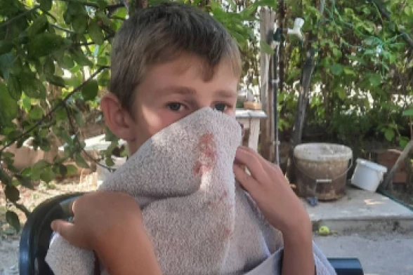 "OBORILI SU GA NA ZEMLJU I TUKLI": Ispovest oca pretučenog dečaka u Kosovskoj Kamenici