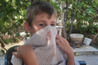 "OBORILI SU GA NA ZEMLJU I TUKLI": Ispovest oca pretučenog dečaka u Kosovskoj Kamenici