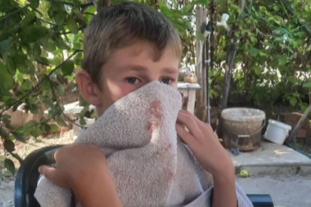 "OBORILI SU GA NA ZEMLJU I TUKLI": Ispovest oca pretučenog dečaka u Kosovskoj Kamenici