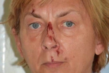 NA STENI NA KRKU PRONAĐENA ŽENA KOJA NE ZNA NI KO JE, NI ŠTA JE, NITI KAKO JE STIGLA U HRVATSKU! U teškom je stanju, POLICIJA MOLI ZA POMOĆ!