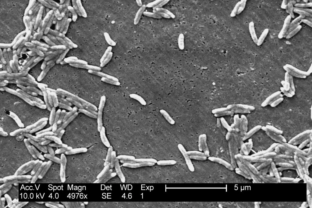 Posle više od četrdeset godina: KOLERA U ŠPANIJI