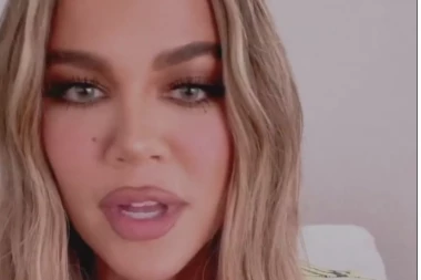 KARDAŠIJANKA PRE OPERACIJA! Da li biste je prepoznali, transformacija je šokantna, hirurg tvrdi: Uradila je mnogo više nego sto priznaje