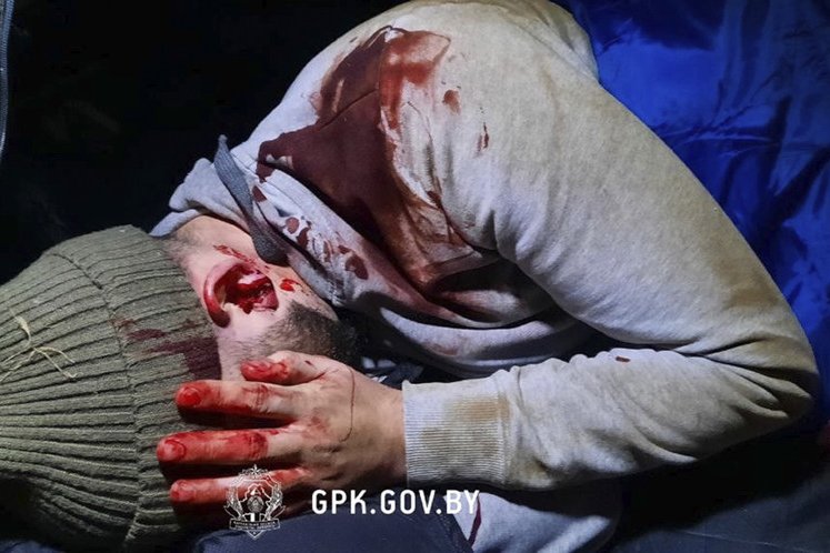 Povređeni migranti pre nekoliko večeri u pokušaju da pređu u EU 