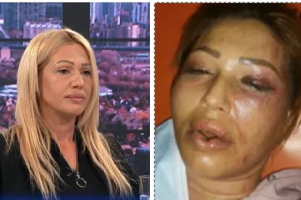 OVO NE SME DA SE DOGAĐA! Brutalno isprebijana Vinka ne sme kući, čak ni dete da vidi! NASILNIK U STANU SLUŽI KAZNU I PRETI JOJ SMRĆU!