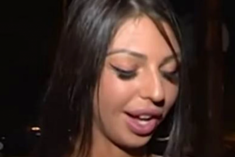 Maja Marinković pre estetskih zahvata
