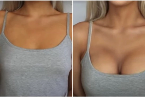 MUŠKARCI VOLE SAMO OVAKVE GRUDI! Doktor objašnjava kakve su najprivlačnije - Siromašni biraju GIGANTSKE, a razlog je baš jasan!