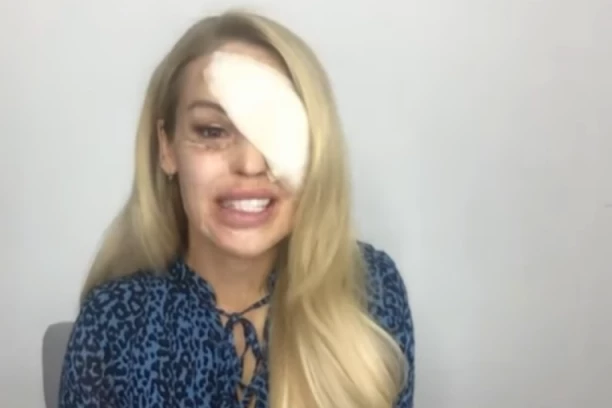 MISICA PREŽIVELA GOLGOTU! Dečko je silovao 8 sati pa polio kiselinom, nakon dve godine se desio potpuni OBRT