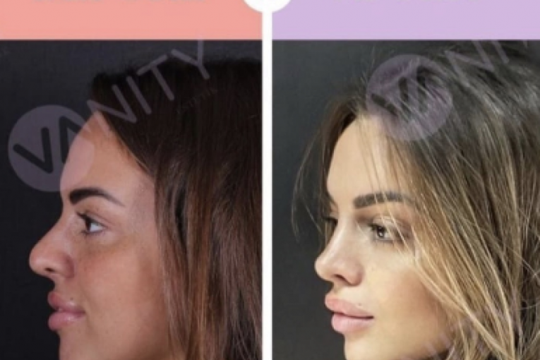 Sofija Šašić pre i posle
