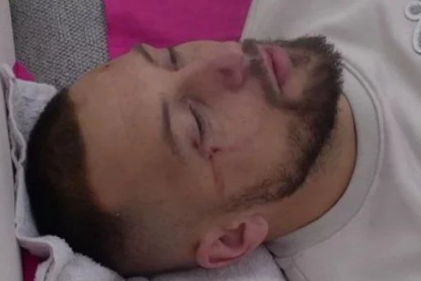 BIVŠI ZADRUGAR POVREĐEN, ČEKA GA OPERACIJA: Oglasio se iz bolničkog kreveta, fanovi preplašeni! (FOTO)