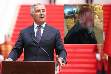 MILOVI BATINAŠI POCEPALI GLAVU ČOVEKU, KRV ŠIKLJALA NA SVE STRANE! Maskirani su mu upali u dvorište nakon što je DPS doživeo NOVI PORAZ! (FOTO)