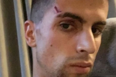 UŽAS U MANČESTERU: Zvezda Sitija POVREĐENA u napadu pljačkaša - branio porodicu protiv ČETVORICE! (FOTO)