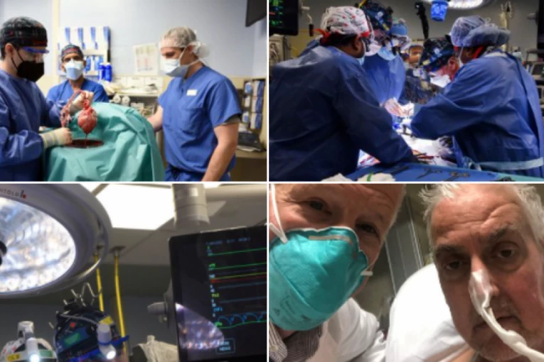ČOVEKU PRESAĐENO SRCE GENETSKI MODIFIKOVANE SVINJE! Revolucija u medicini! PACIJENT SE OPORAVLJA! (FOTO)