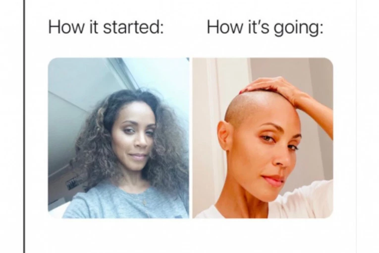 ĆELAVA SAM, PA ŠTA? Džejda Smit otkriva kako se bori sa gubitkom kose