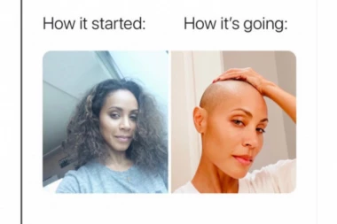 ĆELAVA SAM, PA ŠTA? Džejda Smit otkriva kako se bori sa gubitkom kose