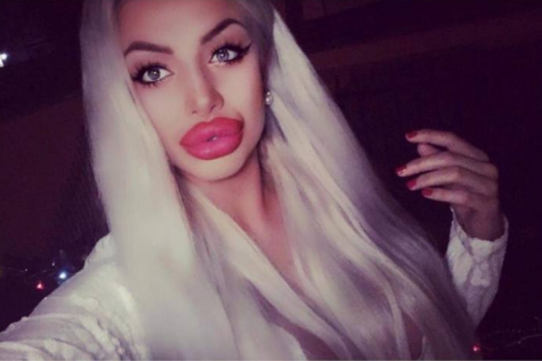 Sanja Grujić pre ulaska u "Zadrugu" gotovo neprepoznatljiva