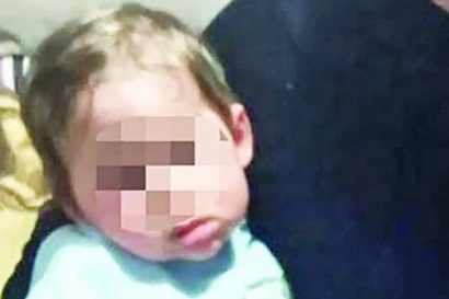 OVO PIŠE U NALAZU OBDUKCIJE DEČAKA (3) IZ NIŠA: Pobija se iskaz majke i babe u vezi opekotina, sahrana o trošku opštine?!