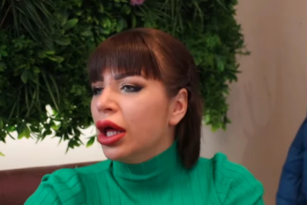 BIVŠI DEČKO MILJANE KULIĆ NASTRADAO: Stravičan prizor, glava mu u RANAMA, moli za pomoć na Instagramu! (FOTO)