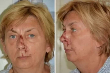 DANIJELA JE VEROVALA DA JE NAŠLA POSAO: Tri nedelje kasnije probudila se krvava na nepoznatom mestu  i nije se sećala šta se dogodilo