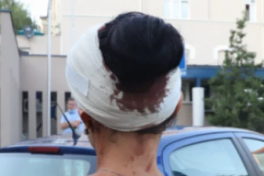 MLADOJ ŠAPČANKI (17) BIVŠI DEČKO RAZBIO GLAVU STAKLENOM FLAŠOM! Prišao joj sa leđa! GODINU I PO JE PROGANJAO!