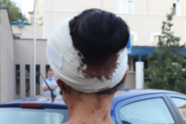 MLADOJ ŠAPČANKI (17) BIVŠI DEČKO RAZBIO GLAVU STAKLENOM FLAŠOM! Prišao joj sa leđa! GODINU I PO JE PROGANJAO!