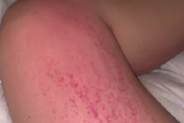 REKLI SU MI DA JE ŠUGA, ALI ZNALA SAM DA NIJE, UPORNO SAM SE VRAĆALA LEKARIMA: Potresna ispovest devojke (23) koja je prošla PAKAO zbog POGREŠNE DIJAGNOZE (FOTO)